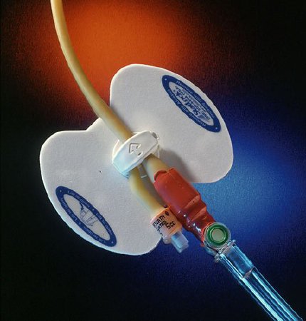Stabilization Device, Foley, Foam Anchor Pad, Perspiration Holes, for Latex Catheters, Adult, 25/cs